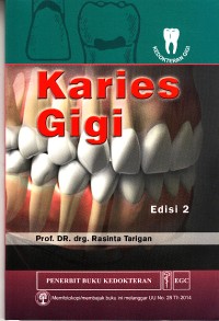 Image of Karies Gigi edisi 2