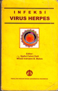 Image of Infeksi Virus Herpes