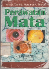 Image of Perawatan Mata